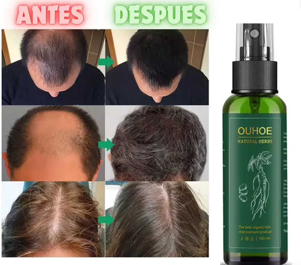 SPRAY PARA CRECER EL PELO OUHOE