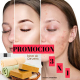 JABÓN DE CÚRCUMA