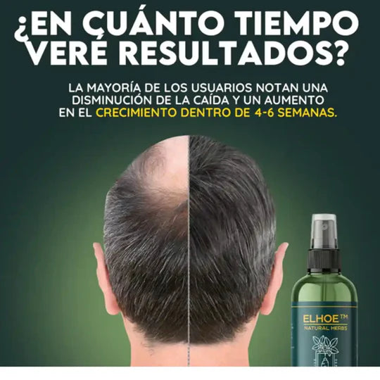 OUHOE - ELIXIR PARA EL CRECIMIENTO DEL CABELLO.